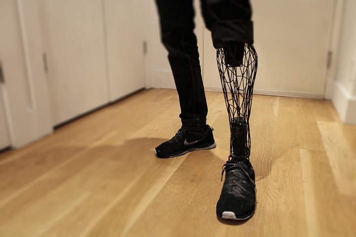 3D-Printed Prosthetic Limbs